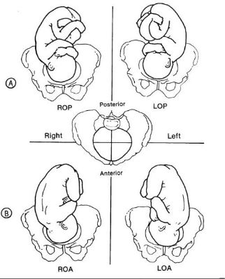 Fetal Position Drawing